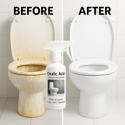 🔥 BUY 1 GET 1 FREE 🔥  Multi-Purpose Oxalic Acid Stain Removal Spray